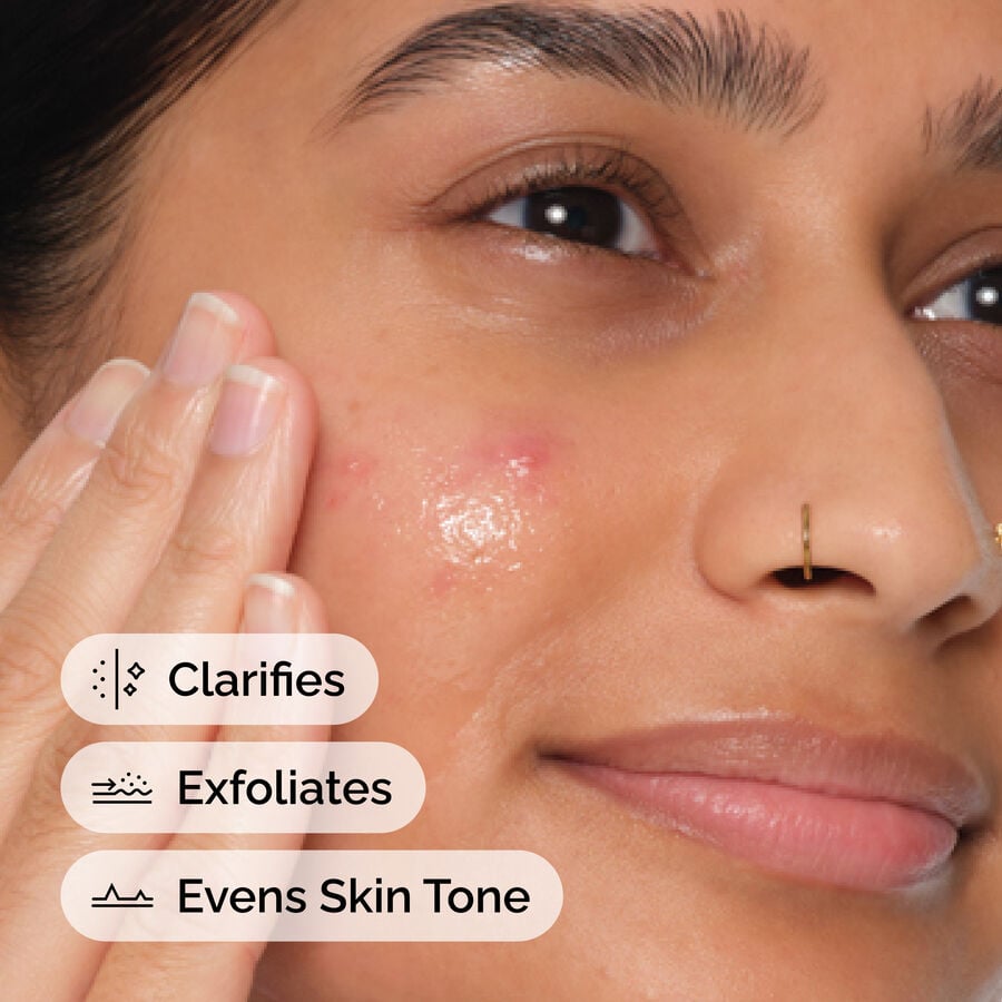 Application of Salicylic Acid 2% Anhydrous Serum